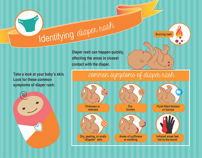 Identifying Diaper Rash